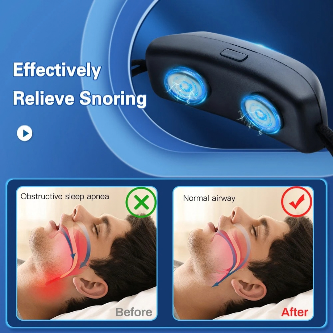 Smart Anti-Snore Chin Device